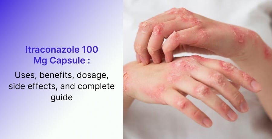 Itraconazole 100 mg Capsule