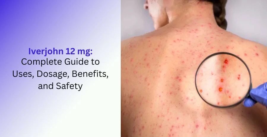 Iverjohn 12 mg