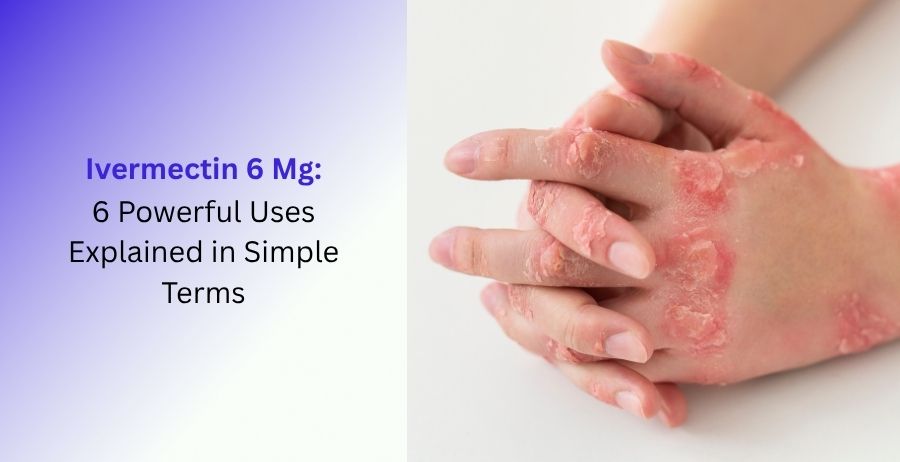 Ivermectin 6 Mg