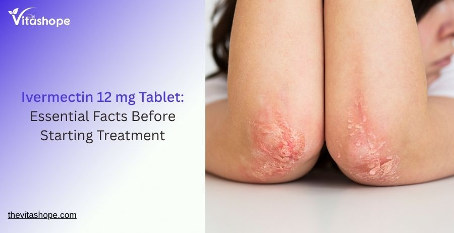 Ivermectin 12 mg: Essential Facts Before Starting Treatment